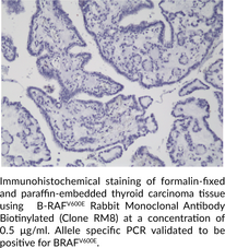 B-RAFV600E Rabbit Monoclonal Antibody Biotinylated (Clone RM8)