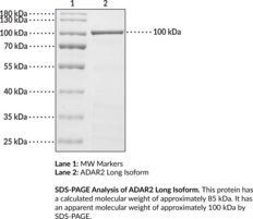 ADAR2 Long Isoform (human, recombinant)