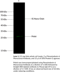 Peroxiredoxin-6 Monoclonal Antibody (Clone 03) (Acidic Calcium-independent  Phospholipase A2, aiPLA2, 1-Cys Peroxiredoxin, Glutathione-dependent  Peroxiredoxin, LPCAT5, Non-selenium Glutathione Peroxidase, NSGPx, Prx6)