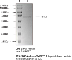 bulletproof upgraded glutathione force gel Exploring the potentials of chitosan as a promising carrier for  methotrexate for beating cancer