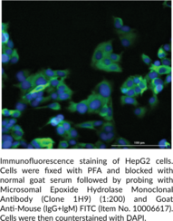 Microsomal Epoxide Hydrolase Monoclonal Antibody (Clone 1H9) (EPHX1, Epoxide Hydratase, Epoxide Hydrolase 1, mEH)