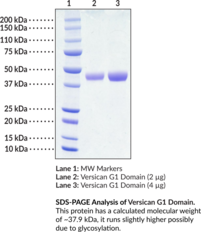 Versican G1 Domain (human, recombinant) (Chondroitin Sulfate Proteoglycan 2, Chondroitin Sulfate Proteoglycan Core Protein 2, CSPG2, ERVR, GHAP, Glial Hyaluronate-binding Protein, Large Fibroblast Proteoglycan, PG-M, VCAN, Versican Core Protein, Versican Proteoglycan, WGN, WGN1)