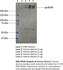 ApoB Polyclonal Antibody (Apolipoprotein B)