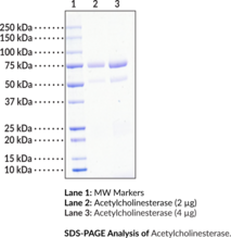 Acetylcholinesterase (eel) (AChE)