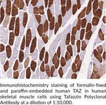 Tafazzin Polyclonal Antibody