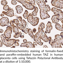 Tafazzin Polyclonal Antibody