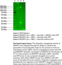 ARMC5 (human, recombinant)