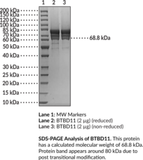 BTBD11 (human, recombinant) (ABTB3, Ankyrin Repeat- and BTB/POZ Domain-containing Protein 3, BTB/POZ Domain-containing Protein 11)
