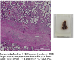 Human Placental Tissue (Basal Plate; Normal) - FFPE Block (Human Placental Tissue (Basal Plate; Normal) - Formalin-Fixed, Paraffin-Embedded Block)