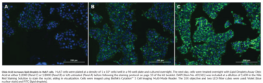 vitamin c lipid rash Pseudovasculitic Scurvy Mimicking Small Vessel Vasculitis: A Case Report