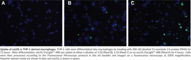 Oxidized LDL Uptake Assay Kit