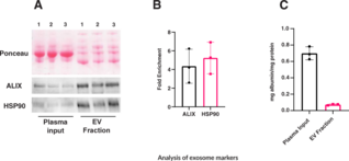 Extracellular Vesicle Isolation Kit (plasma and serum)