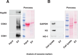 Extracellular Vesicle Isolation Kit (Tissue Culture)